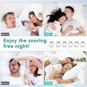Clips para dormir ronquidos, dispositivos antirronquidos, clip de nariz antirronquidos, clip de nariz para ronquidos, solución para ronquidos para un sueño cómodo.